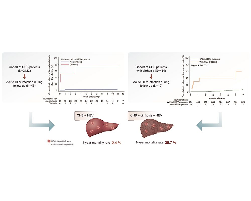 When Hepatitis E meets Hepatitis B-封面圖